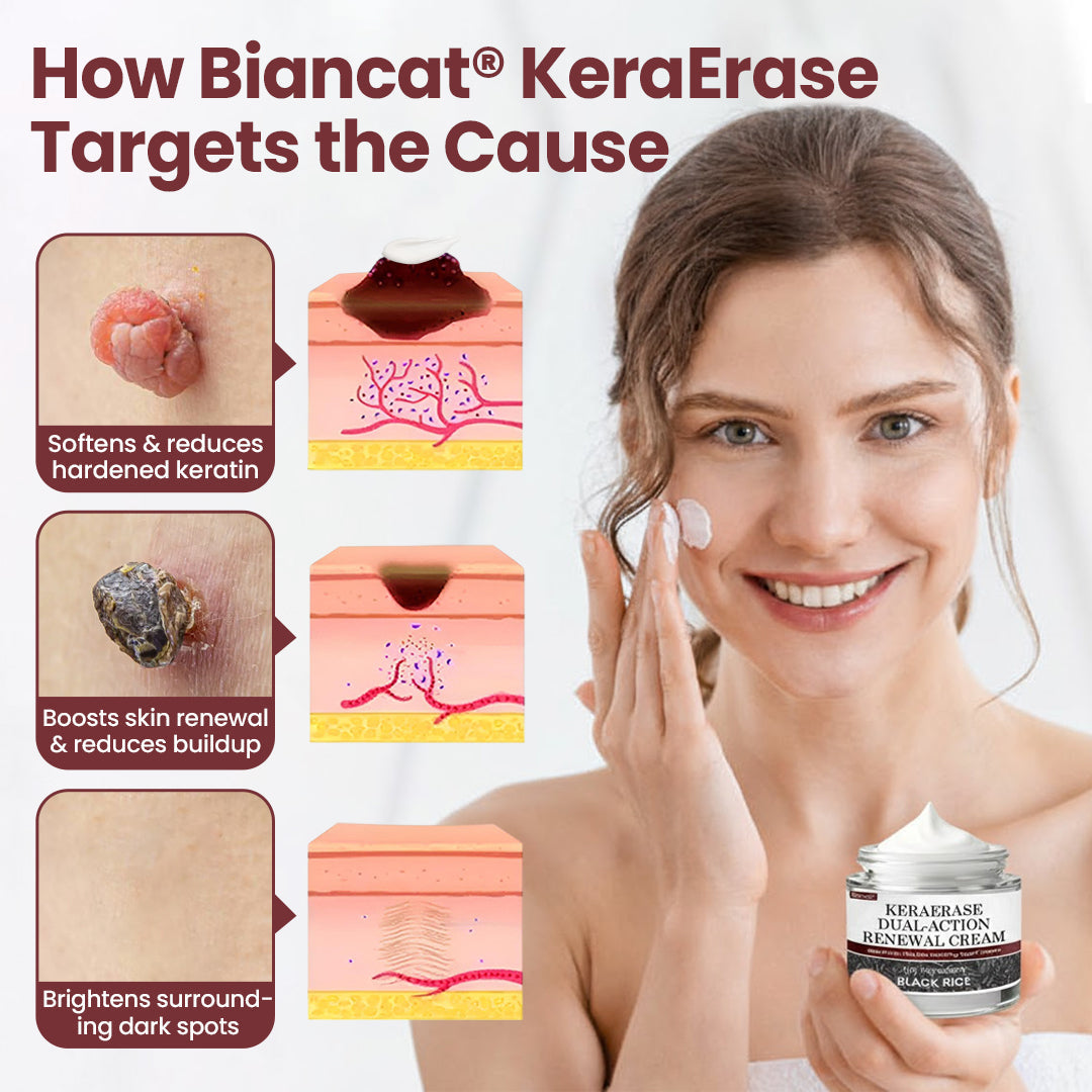 Biancat®KeraErase Dual-Action Renewal Cream🔥