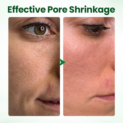 Biancat® PoreMelt Avocado Acid Mask