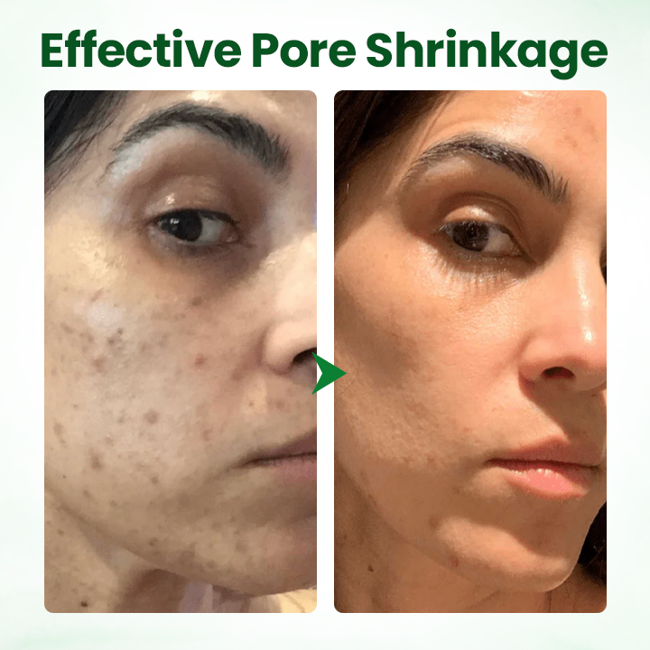 Biancat® PoreMelt Avocado Acid Mask