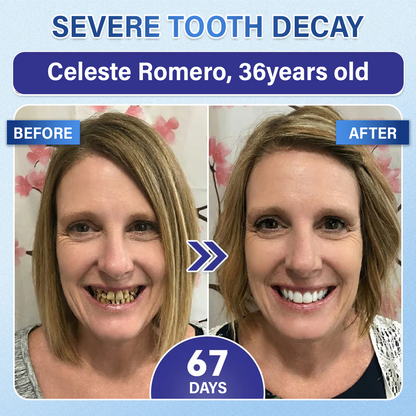 Your Smile🦷Ceoerty® Tooth & Gum Care Fast-Dissolving Microneedle Patch✨ (𝟓-𝐢𝐧-𝟏 💎 𝐑𝐞𝐛𝐮𝐢𝐥𝐝 𝐄𝐧𝐚𝐦𝐞𝐥 & 𝐃𝐞𝐧𝐭𝐢𝐧 • 𝐒𝐭𝐫𝐞𝐧𝐠𝐭𝐡𝐞𝐧 𝐆𝐮𝐦𝐬 • 𝐄𝐫𝐚𝐝𝐢𝐜𝐚𝐭𝐞 𝐓𝐚𝐫𝐭𝐚𝐫 & 𝐎𝐝𝐨𝐫 • 𝐖𝐡𝐢𝐭𝐞𝐧𝐢𝐧𝐠 • 𝐒𝐭𝐨𝐩 𝐓𝐨𝐨𝐭𝐡 𝐒𝐞𝐧𝐬𝐢𝐭𝐢𝐯𝐢𝐭𝐲)