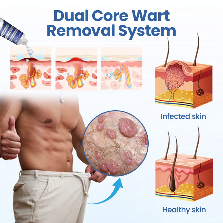 Timilk® GentX WartRelief Cream