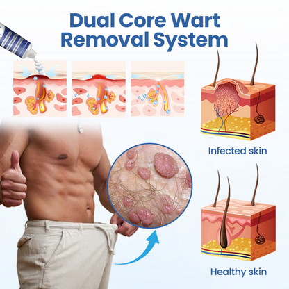 Timilk® GentX WartRelief Cream