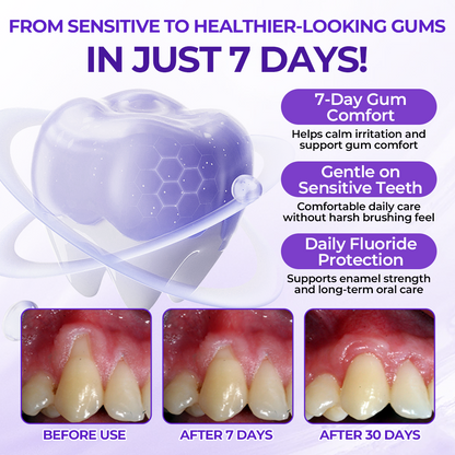 Biancat® SensiGum Fluoride Toothpaste