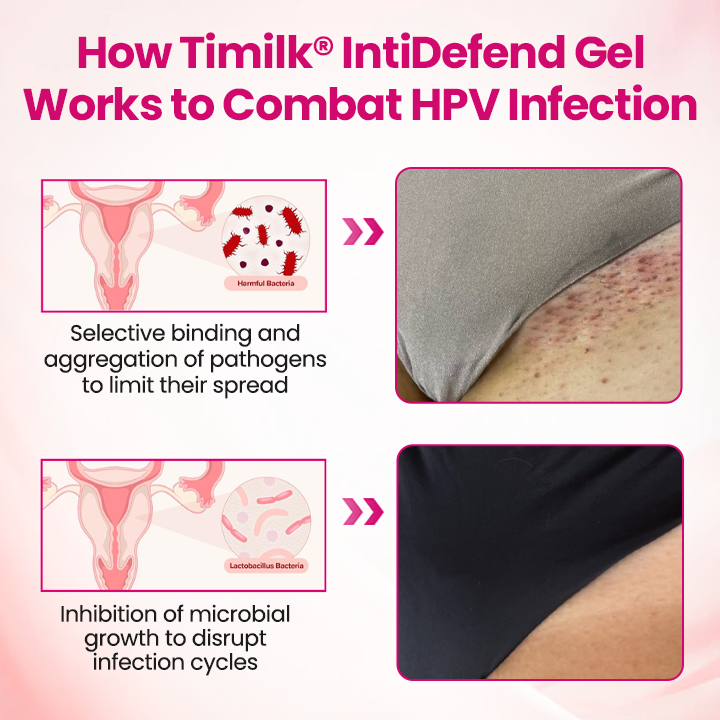Timilk® IntiDefend Anti-HPV Interferon Gel