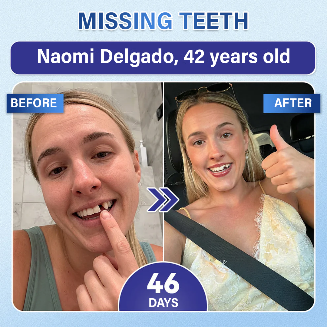 Your Smile🦷Ceoerty® Tooth & Gum Care Fast-Dissolving Microneedle Patch✨ (𝟓-𝐢𝐧-𝟏 💎 𝐑𝐞𝐛𝐮𝐢𝐥𝐝 𝐄𝐧𝐚𝐦𝐞𝐥 & 𝐃𝐞𝐧𝐭𝐢𝐧 • 𝐒𝐭𝐫𝐞𝐧𝐠𝐭𝐡𝐞𝐧 𝐆𝐮𝐦𝐬 • 𝐄𝐫𝐚𝐝𝐢𝐜𝐚𝐭𝐞 𝐓𝐚𝐫𝐭𝐚𝐫 & 𝐎𝐝𝐨𝐫 • 𝐖𝐡𝐢𝐭𝐞𝐧𝐢𝐧𝐠 • 𝐒𝐭𝐨𝐩 𝐓𝐨𝐨𝐭𝐡 𝐒𝐞𝐧𝐬𝐢𝐭𝐢𝐯𝐢𝐭𝐲)