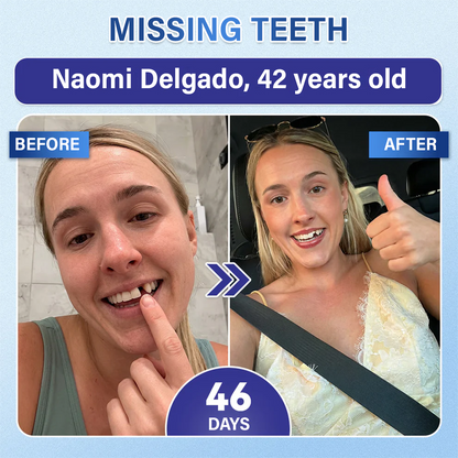 Your Smile🦷Ceoerty® Tooth & Gum Care Fast-Dissolving Microneedle Patch✨ (𝟓-𝐢𝐧-𝟏 💎 𝐑𝐞𝐛𝐮𝐢𝐥𝐝 𝐄𝐧𝐚𝐦𝐞𝐥 & 𝐃𝐞𝐧𝐭𝐢𝐧 • 𝐒𝐭𝐫𝐞𝐧𝐠𝐭𝐡𝐞𝐧 𝐆𝐮𝐦𝐬 • 𝐄𝐫𝐚𝐝𝐢𝐜𝐚𝐭𝐞 𝐓𝐚𝐫𝐭𝐚𝐫 & 𝐎𝐝𝐨𝐫 • 𝐖𝐡𝐢𝐭𝐞𝐧𝐢𝐧𝐠 • 𝐒𝐭𝐨𝐩 𝐓𝐨𝐨𝐭𝐡 𝐒𝐞𝐧𝐬𝐢𝐭𝐢𝐯𝐢𝐭𝐲)