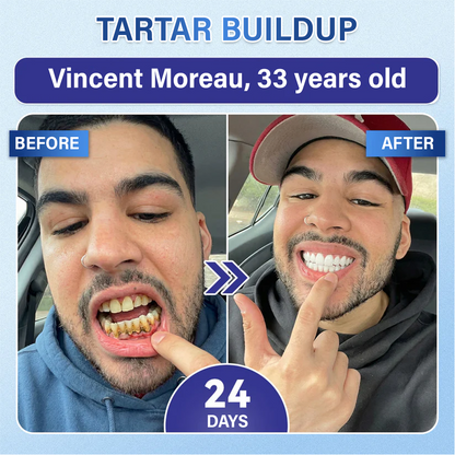 Your Smile🦷Ceoerty® Tooth & Gum Care Fast-Dissolving Microneedle Patch✨ (𝟓-𝐢𝐧-𝟏 💎 𝐑𝐞𝐛𝐮𝐢𝐥𝐝 𝐄𝐧𝐚𝐦𝐞𝐥 & 𝐃𝐞𝐧𝐭𝐢𝐧 • 𝐒𝐭𝐫𝐞𝐧𝐠𝐭𝐡𝐞𝐧 𝐆𝐮𝐦𝐬 • 𝐄𝐫𝐚𝐝𝐢𝐜𝐚𝐭𝐞 𝐓𝐚𝐫𝐭𝐚𝐫 & 𝐎𝐝𝐨𝐫 • 𝐖𝐡𝐢𝐭𝐞𝐧𝐢𝐧𝐠 • 𝐒𝐭𝐨𝐩 𝐓𝐨𝐨𝐭𝐡 𝐒𝐞𝐧𝐬𝐢𝐭𝐢𝐯𝐢𝐭𝐲)