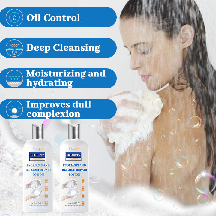 Ceoerty® Psoriasis and Blemish Repair Lotion 🔥