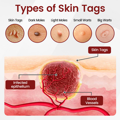 Ceoerty® KeraErase Black Rice Renewal Ampoule 🇺🇸