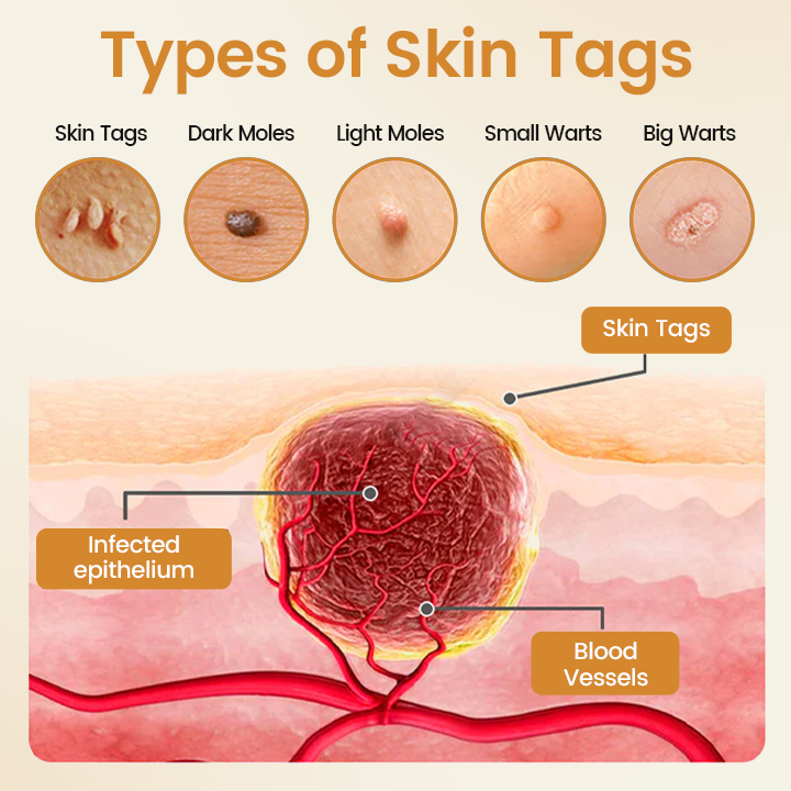 Timilk® BeeVenom Wart Renewal Spray 🇺🇸