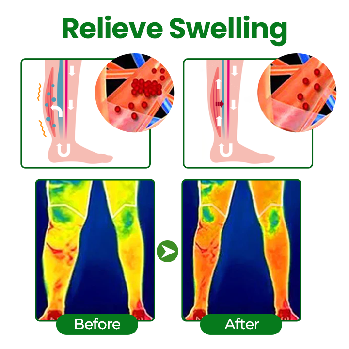 Timilk® VenoLift Leg Relief Spray