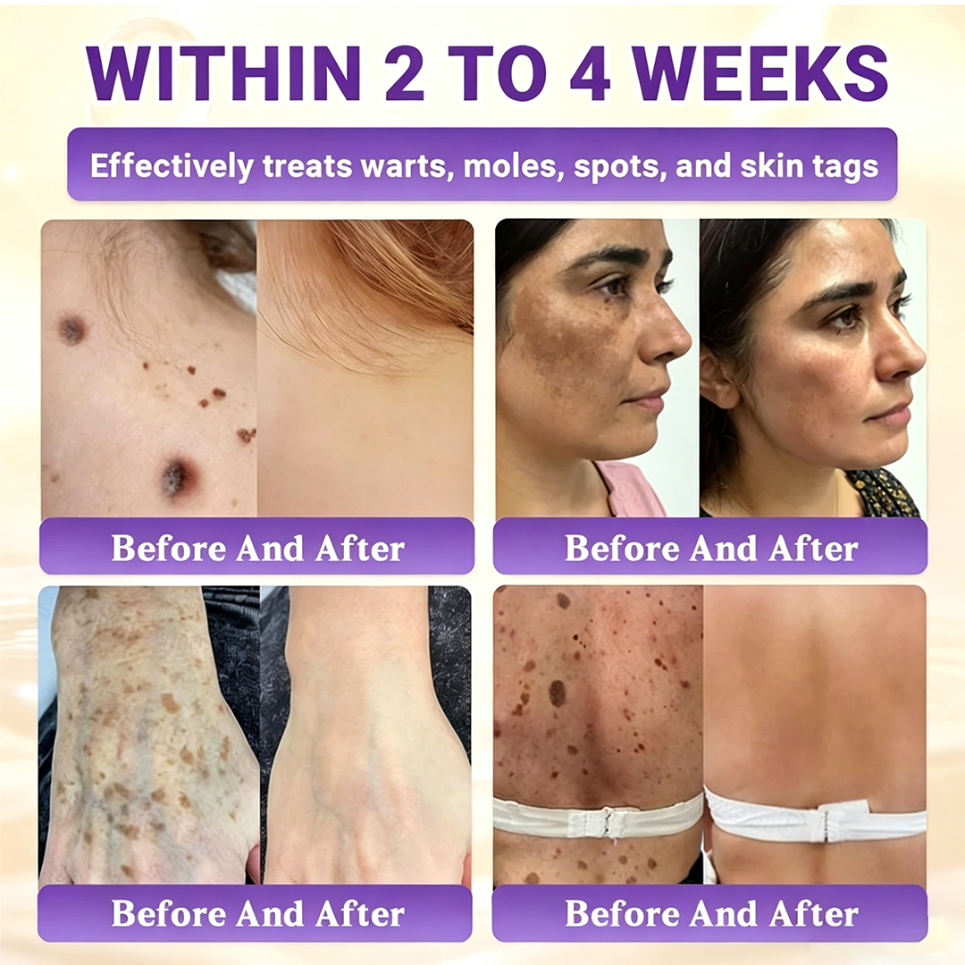 Timilk® BioColla DermaRenew Cream