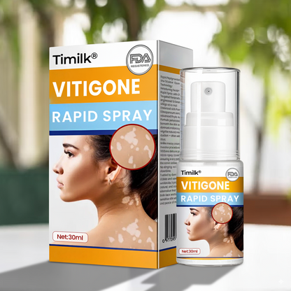 Timilk® VitiGone Rapid Spray — 2–3 Week Repigmentation with OTDS 😃