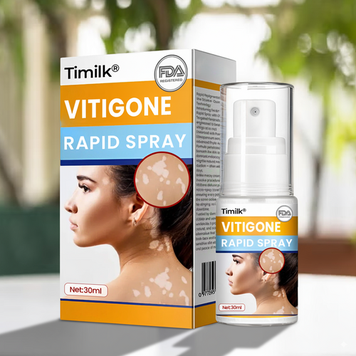 Timilk® VitiGone Rapid Spray — 2–3 Week Repigmentation with OTDS 😃