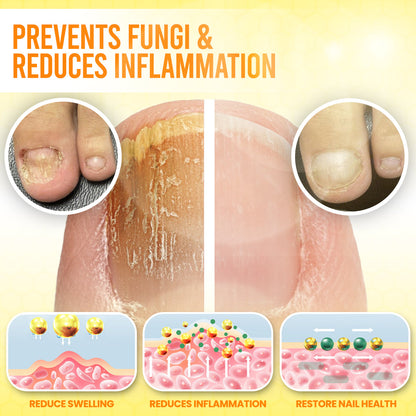 Timilk® ClariNail Bee Venom Fungal Solution Drops