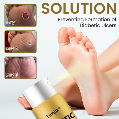 Timilk® Diabetic Foot Healing Spray – Bee Venom Infused 2.0