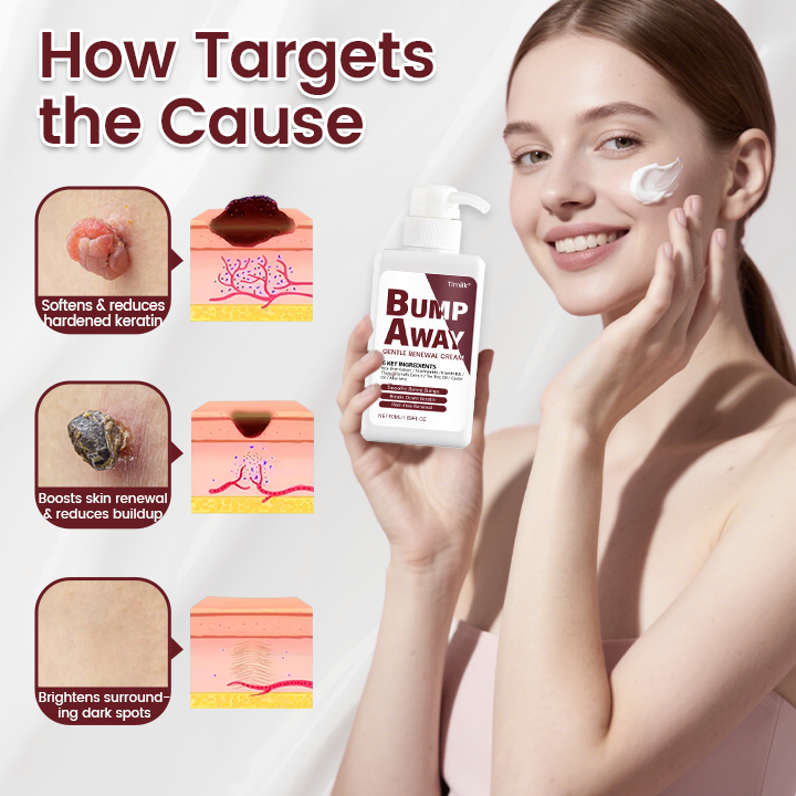 Timilk® BumpAway Gentle Renewal Cream