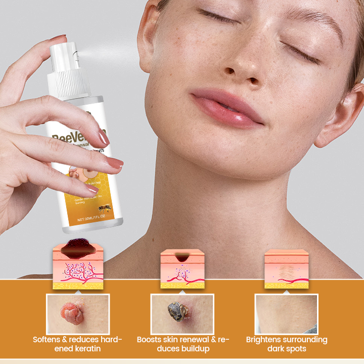 Timilk® BeeVenom Wart Renewal Spray 🇺🇸