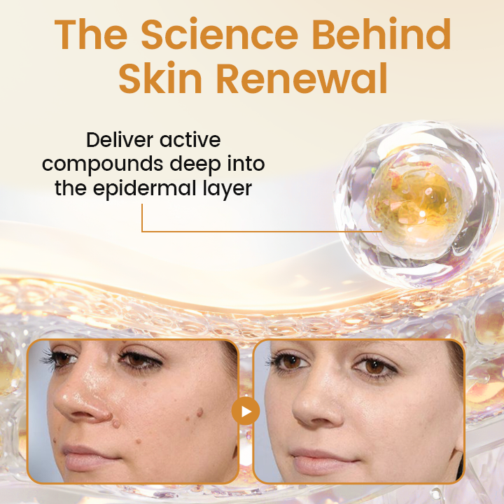 Timilk® BeeVenom Wart Renewal Spray 🇺🇸