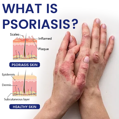 Timilk® DermaSooth Repair Cream