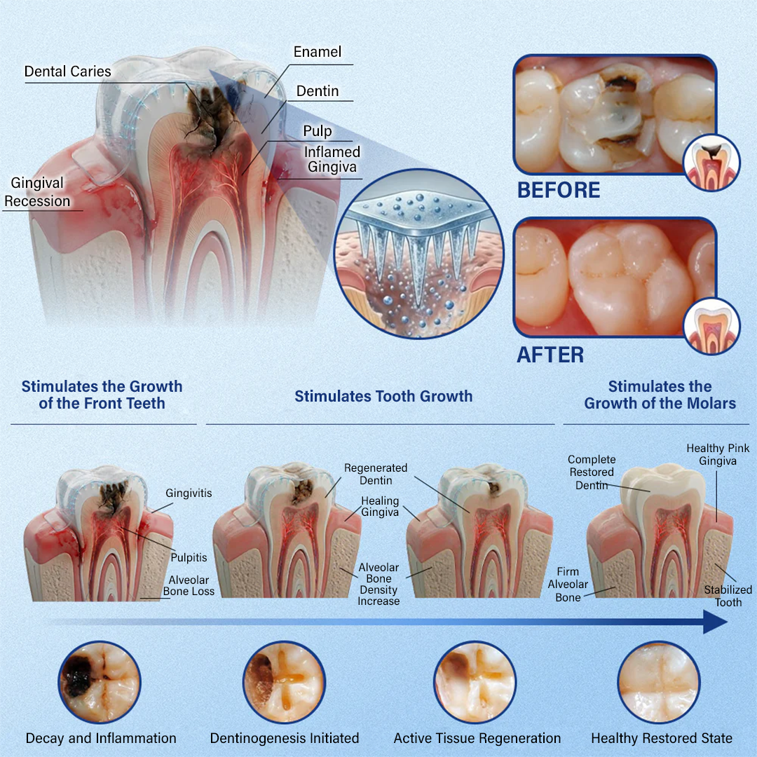 Your Smile🦷Ceoerty® Tooth & Gum Care Fast-Dissolving Microneedle Patch✨ (𝟓-𝐢𝐧-𝟏 💎 𝐑𝐞𝐛𝐮𝐢𝐥𝐝 𝐄𝐧𝐚𝐦𝐞𝐥 & 𝐃𝐞𝐧𝐭𝐢𝐧 • 𝐒𝐭𝐫𝐞𝐧𝐠𝐭𝐡𝐞𝐧 𝐆𝐮𝐦𝐬 • 𝐄𝐫𝐚𝐝𝐢𝐜𝐚𝐭𝐞 𝐓𝐚𝐫𝐭𝐚𝐫 & 𝐎𝐝𝐨𝐫 • 𝐖𝐡𝐢𝐭𝐞𝐧𝐢𝐧𝐠 • 𝐒𝐭𝐨𝐩 𝐓𝐨𝐨𝐭𝐡 𝐒𝐞𝐧𝐬𝐢𝐭𝐢𝐯𝐢𝐭𝐲)