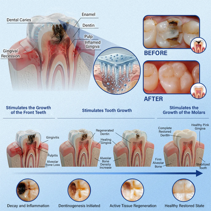 Your Smile🦷Ceoerty® Tooth & Gum Care Fast-Dissolving Microneedle Patch✨ (𝟓-𝐢𝐧-𝟏 💎 𝐑𝐞𝐛𝐮𝐢𝐥𝐝 𝐄𝐧𝐚𝐦𝐞𝐥 & 𝐃𝐞𝐧𝐭𝐢𝐧 • 𝐒𝐭𝐫𝐞𝐧𝐠𝐭𝐡𝐞𝐧 𝐆𝐮𝐦𝐬 • 𝐄𝐫𝐚𝐝𝐢𝐜𝐚𝐭𝐞 𝐓𝐚𝐫𝐭𝐚𝐫 & 𝐎𝐝𝐨𝐫 • 𝐖𝐡𝐢𝐭𝐞𝐧𝐢𝐧𝐠 • 𝐒𝐭𝐨𝐩 𝐓𝐨𝐨𝐭𝐡 𝐒𝐞𝐧𝐬𝐢𝐭𝐢𝐯𝐢𝐭𝐲)