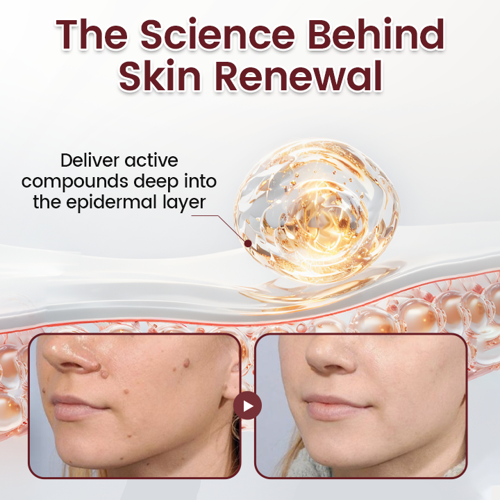 Timilk® BumpAway Gentle Renewal Cream