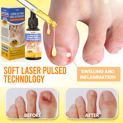 Timilk® ClariNail Bee Venom Fungal Solution Drops