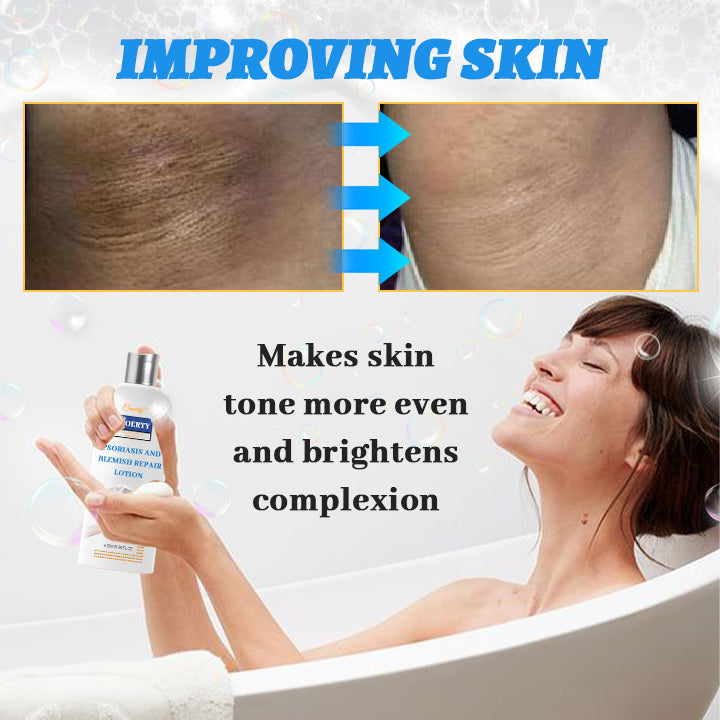 Ceoerty® Psoriasis and Blemish Repair Lotion 🔥