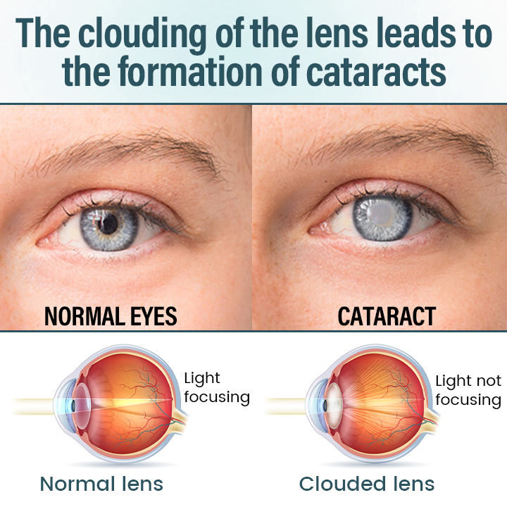 Timilk® OptiFusion Nano Eye Drops Serum 🔥