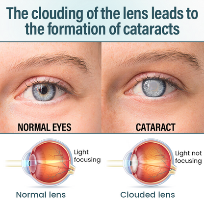 Timilk® OptiFusion Nano Eye Drops Serum 🔥