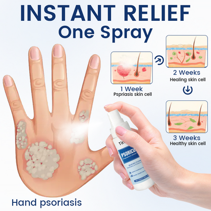 Timilk® PsoriCure Magnesium Herbal Spray