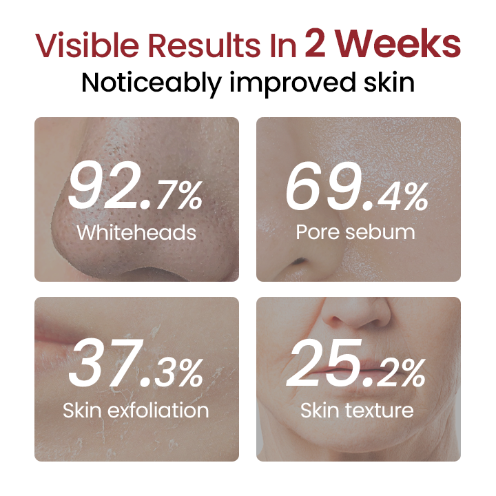 Biancat® Peel Shot Glow Black Rice Ampoule