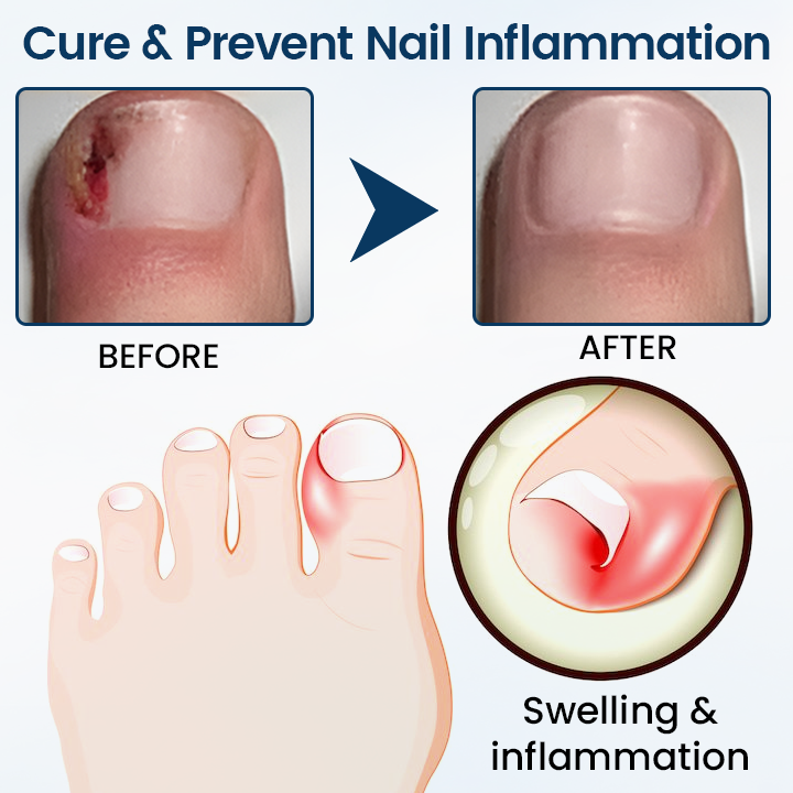 Timilk® OnyxiGuard Fungal Repair Herbal Spray