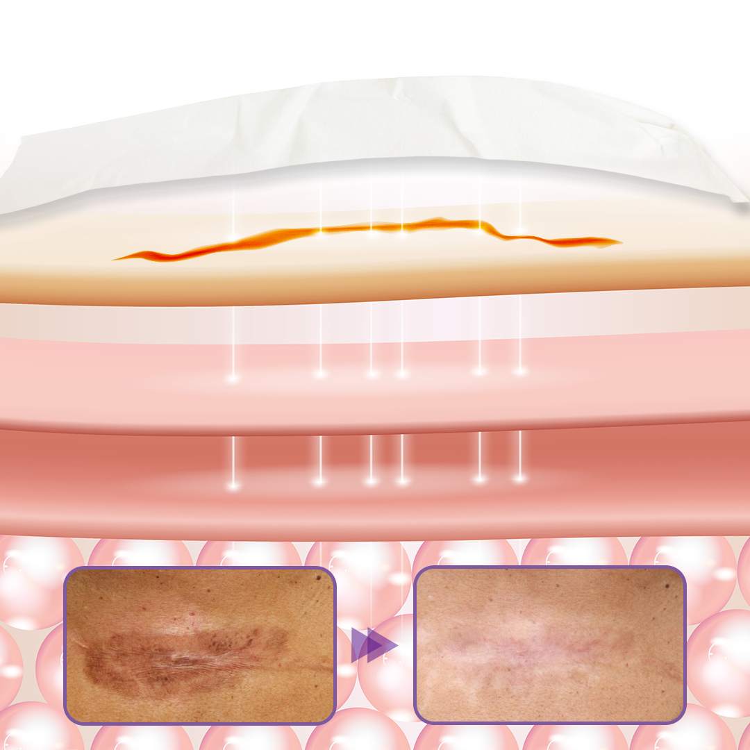 Timilk® HyaRepair Microneedle Skin Tape 🔥