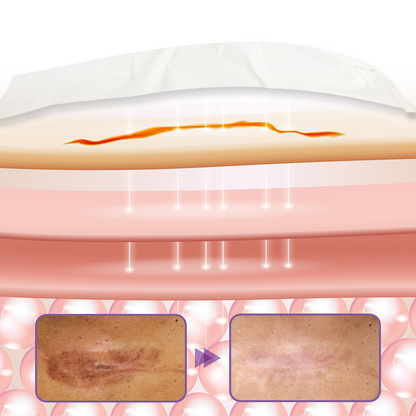 Timilk® HyaRepair Microneedle Skin Tape 🔥