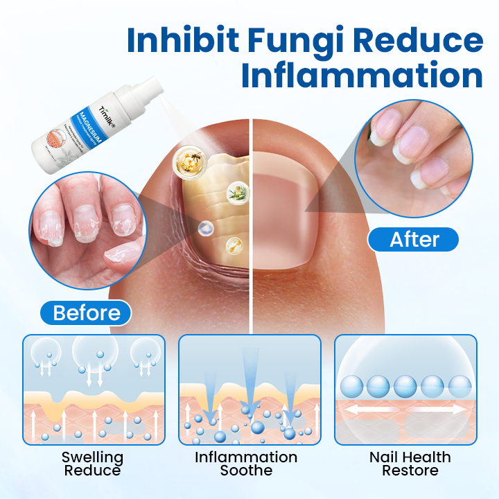 Timilk® Magnesium Herbal Treatment Spray