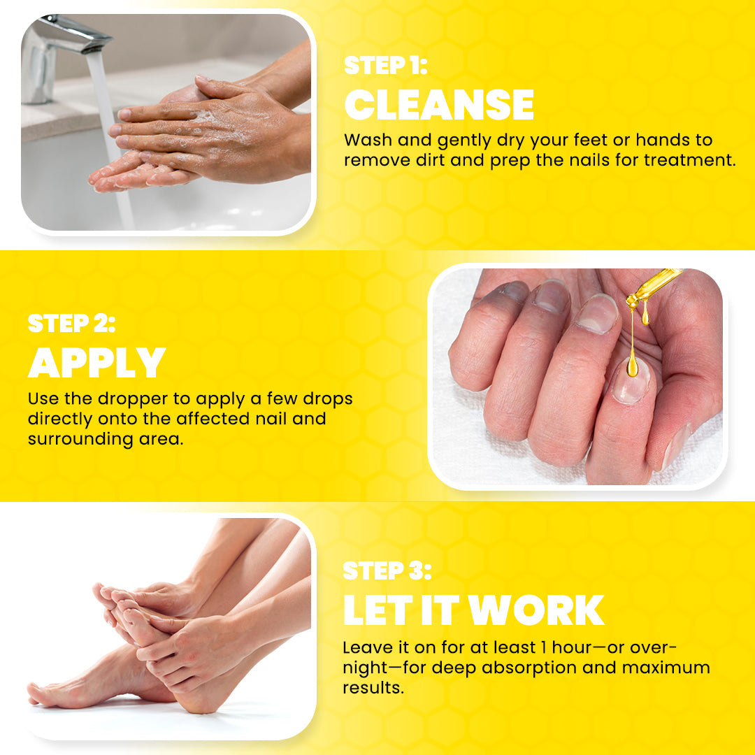 Timilk® ClariNail Bee Venom Fungal Solution Drops