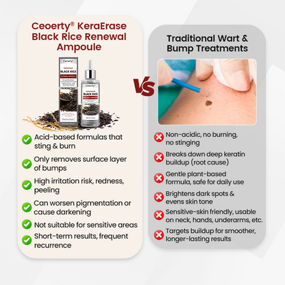 Ceoerty® KeraErase Black Rice Renewal Ampoule 🇺🇸