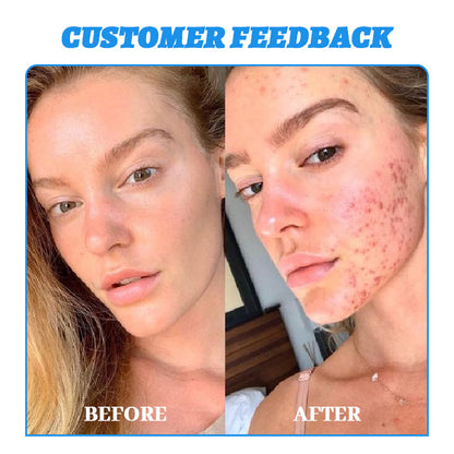 Ceoerty® Psoriasis and Blemish Repair Lotion 🔥