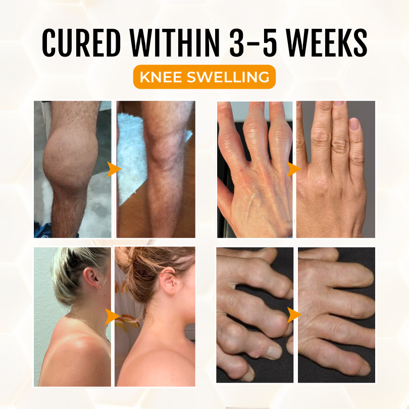 Timilk® ArthriGone Magnesium Oil & Bee Venom Joint Care Spray