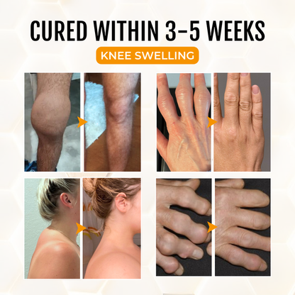 Timilk® ArthriGone Magnesium Oil & Bee Venom Joint Care Spray