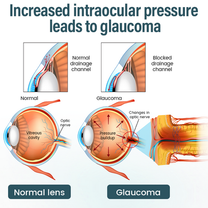 Timilk® OptiFusion Nano Eye Drops Serum 🔥