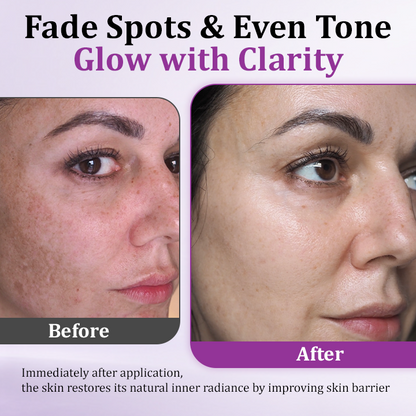 Ceoerty® MelantraX Advanced Anti-Hyperpigmentation Essence