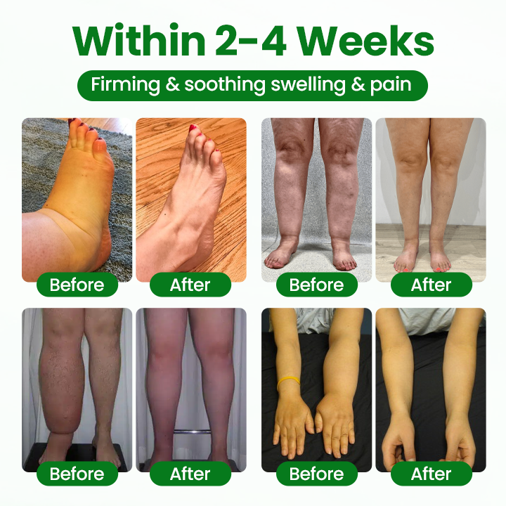 Timilk® VenoLift Leg Relief Spray