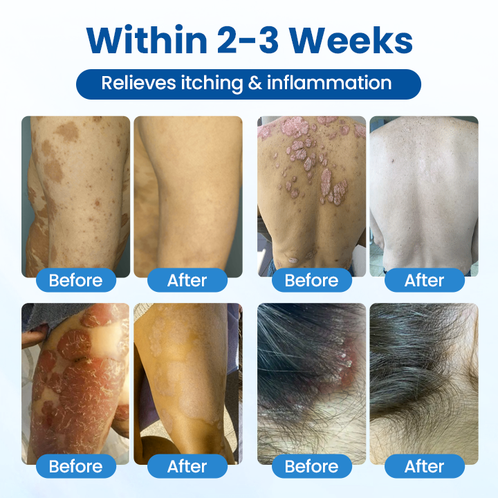 Timilk® Magnesium Herbal Treatment Spray