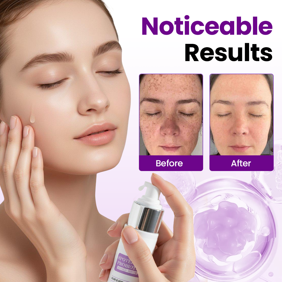 Biancat® SpotErase Probiotic Shield Serum 🇺🇸