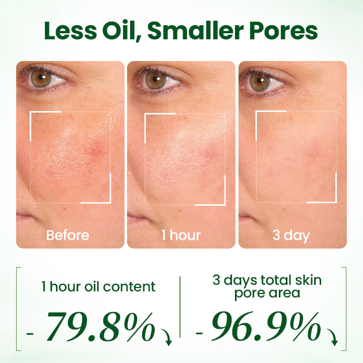 Biancat® PoreMelt Avocado Acid Mask