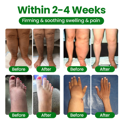 Timilk® VenoLift Leg Relief Spray