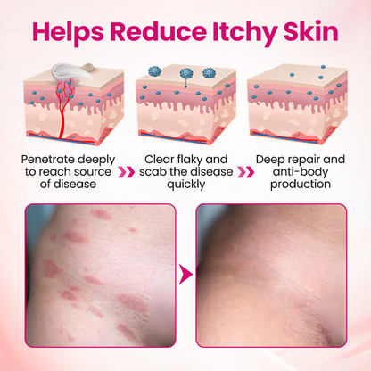 Timilk® IntiDefend Anti-HPV Interferon Gel